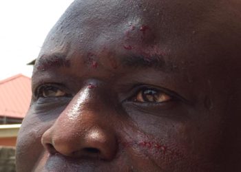 Ace Journalist Amin Lamptey physically attacked by Dreams FC Chief Jiji Alifoe for ‘constantly criticizing’ Ghana FA President Kurt Okraku